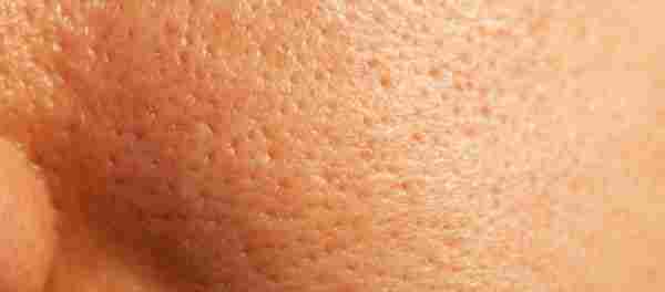 OPEN PORES